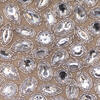19" Burlap Silver Jewel Stocking - view 3 of 4